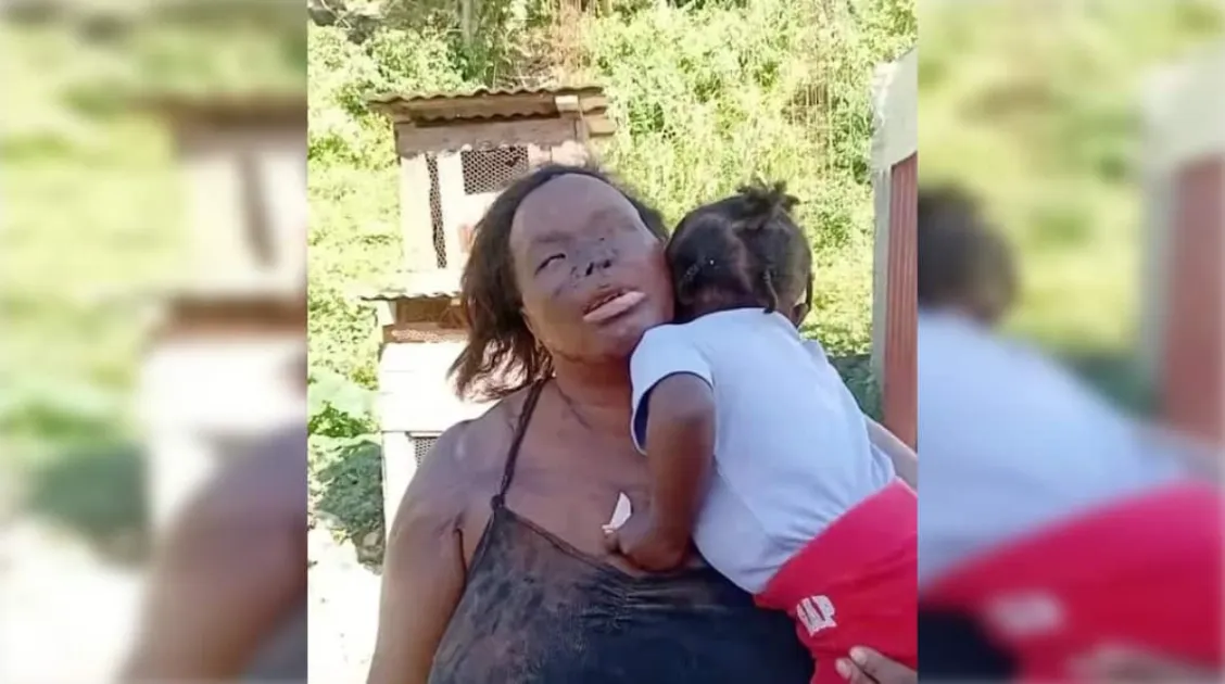 Jamaican mother left permanently blind after attack by stranger she helped at work 