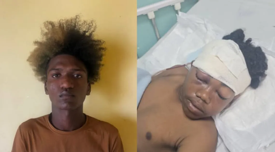 Guyana: 13-year-old fighting for life after bus assault, 2 teenagers charged