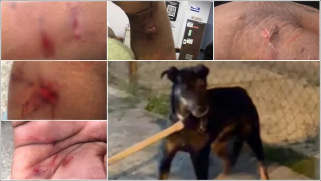 Trinidad: Mother and son mauled by family dog, backlash erupts after animal euthanised 