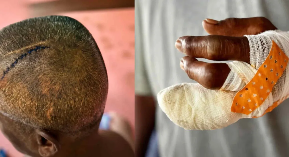 Guyana: 80-year-old woman saves boy as armed gang chops father in broad d...