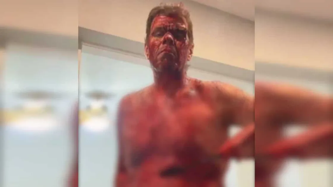 Celebrity blogger Perez Hilton cuts himself multiple times on TikTok live - WIC News